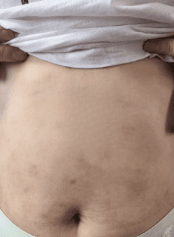 Body Comparison After