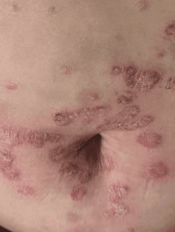 Body Comparison Before