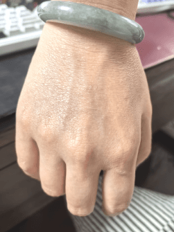 Hand Comparison After